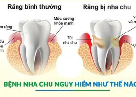 benhnhachu585x372-8746.jpg